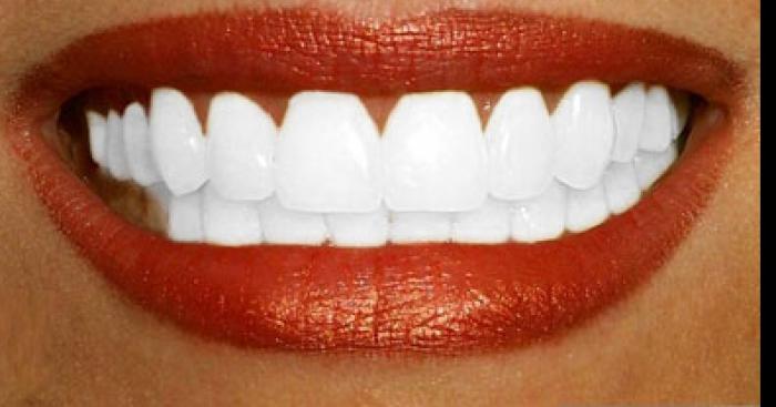 Comment avoir des dents blanches sans dépenser?