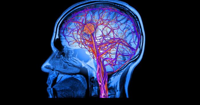 Une étude scientifique sur la connerie humaine aurait révélé...