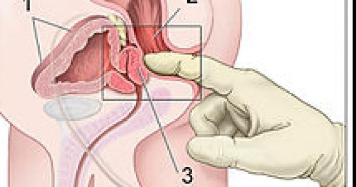Le toucher rectal enseigné au collège dès la rentrée