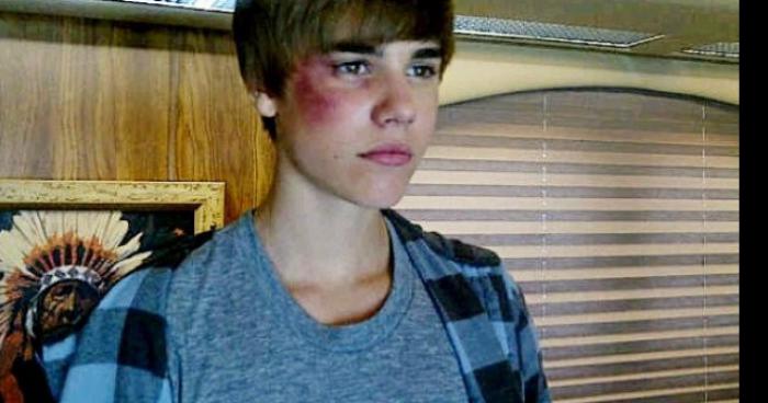 Justin Bieber Est Hospitalis